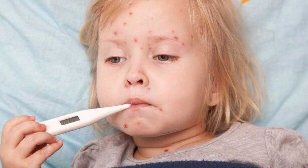 alerta sanitara in romania rujeola a revenit la nivelul de acum 50 de ani 6904db46394ec