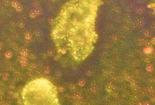 nanoparticule de aur descoperite in ace de molid cum pot influenta bacteriile din interiorul plantelor acumularea metalului in copaci 68e7bf33be093