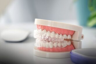 cum afecteaza bruxismul fizionomia fetei 691ae3c6592c3