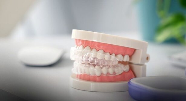 cum afecteaza bruxismul fizionomia fetei 691ae3c6592c3