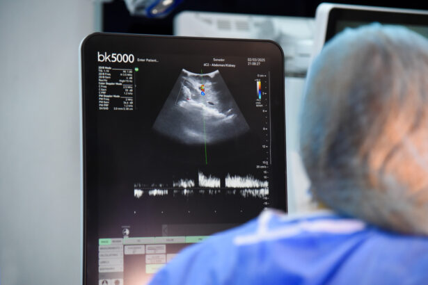 84 de donatori si aproape 300 de transplanturi in romania de la inceputul anului 692d97a4d6628