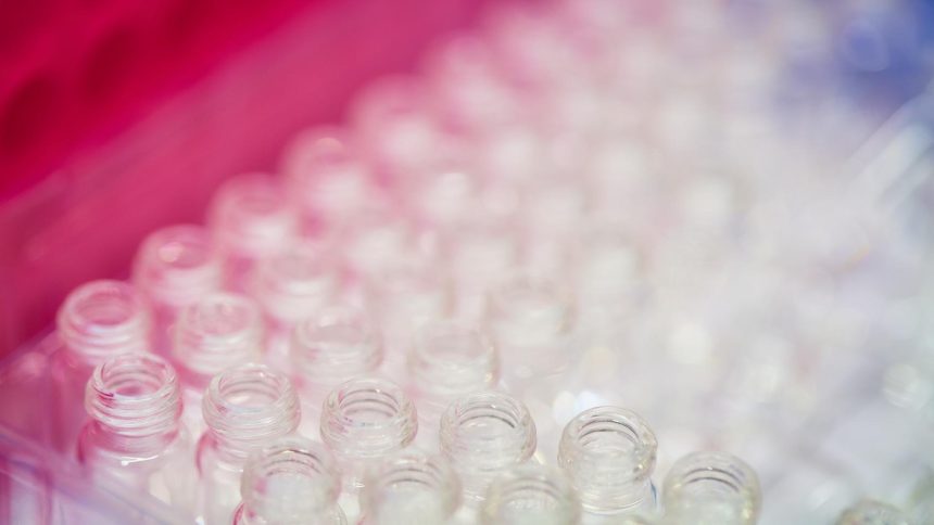 o forma simplificata a tratamentului atrofiei musculare spinale este disponibila acum si in romania 6996b31c41472