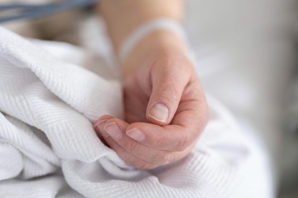 tanara desfigurata intr un spa al unui hotel din brasov dosarul trimis in judecata dupa 4 ani 6984f9cd9c834