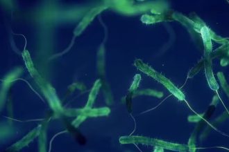 alerta medicala in sua a reaparut bacteria mancatoare de carne 69e9ee328bd50