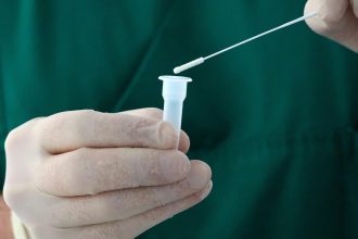 mii de oameni din uganda expusi riscului de infectare cu un virus fara leac transmis de lilieci 69ea2c7de125b