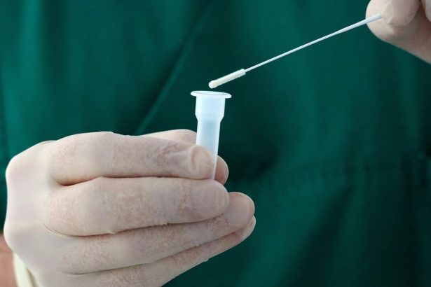 mii de oameni din uganda expusi riscului de infectare cu un virus fara leac transmis de lilieci 69ea2c7de125b