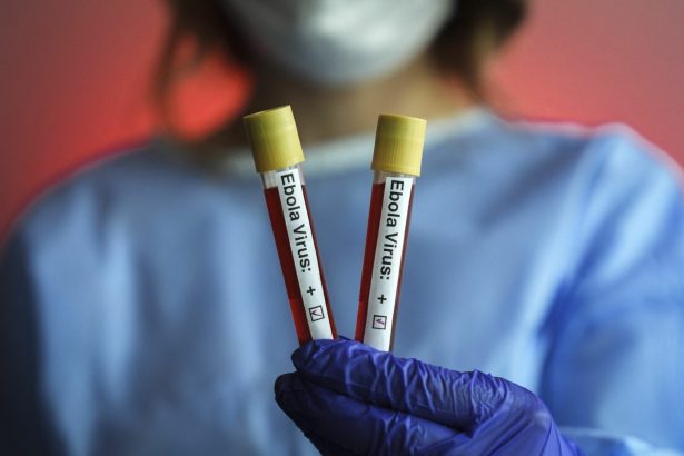 ebola peste 1 000 de cazuri confirmate si 254 de decese in congo 6a38f5f0305dc